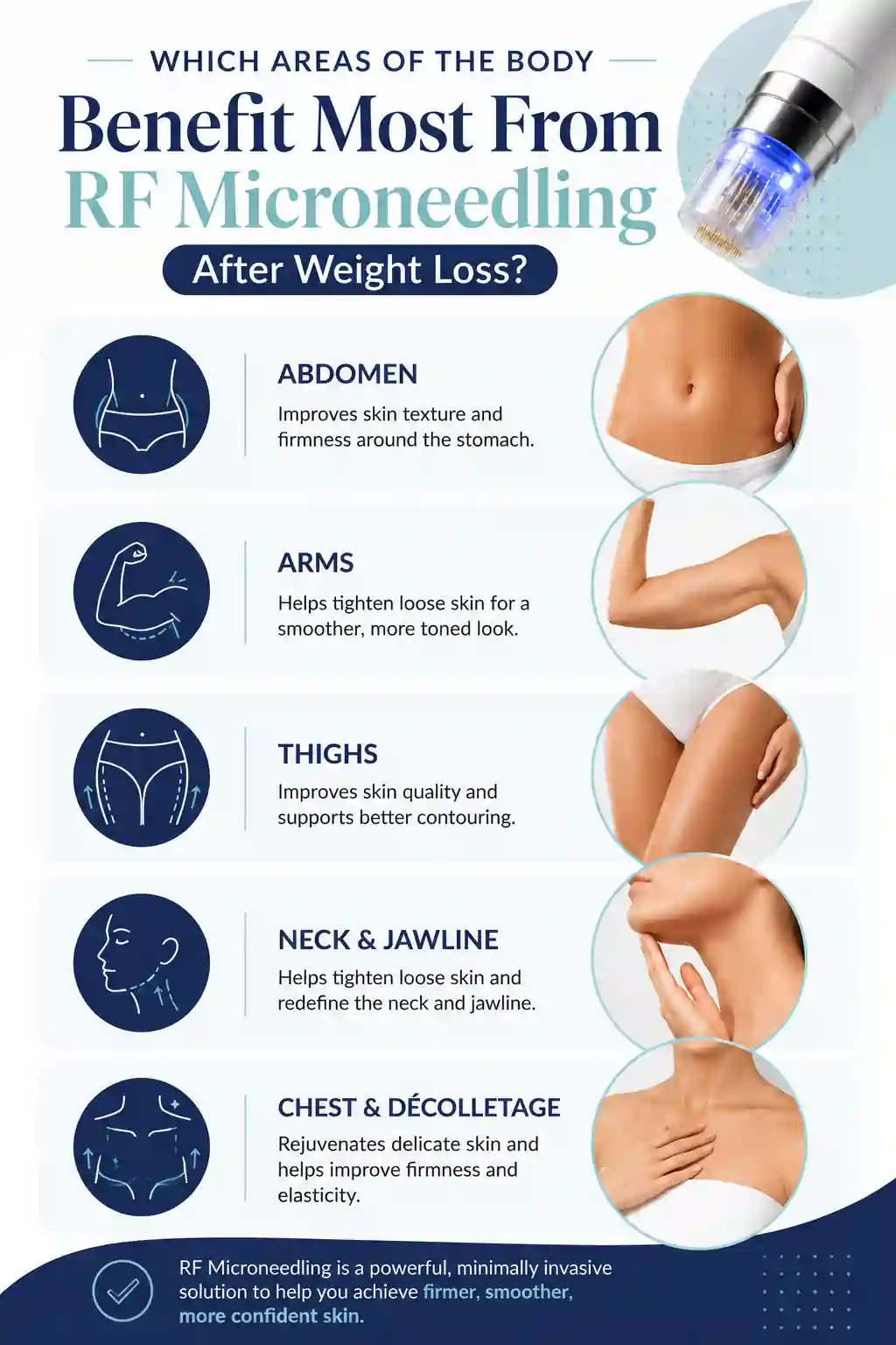 Which Areas of the Body Benefit Most From RF Microneedling After Weight Loss Buckinghamshire